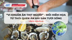 Vibrio vulnificus