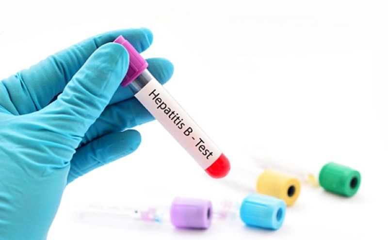 Xét nghiệm Viêm gan B (HBV) 