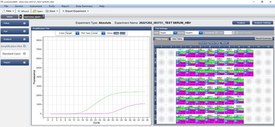 Hình 5. Trường hợp mẫu dương tính HBV