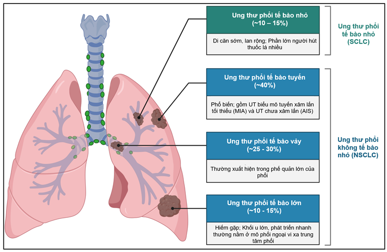 Hình 1: ddPCR - Phân loại ung thư phổi không tế bào nhỏ